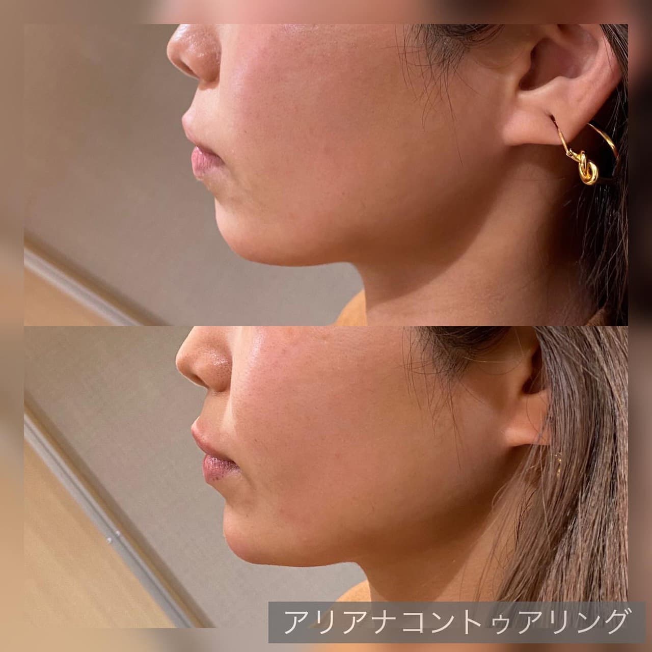 症例写真