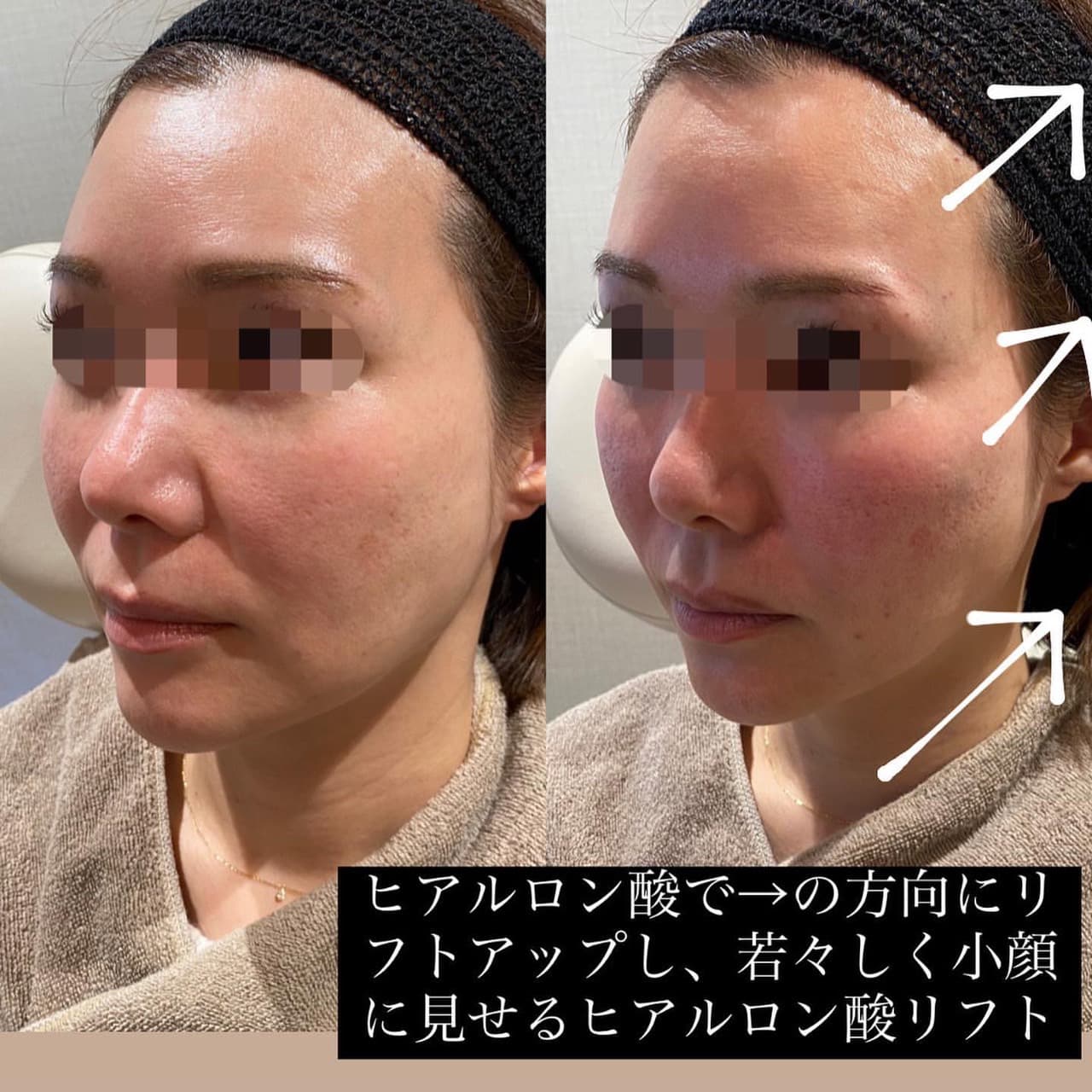 症例写真