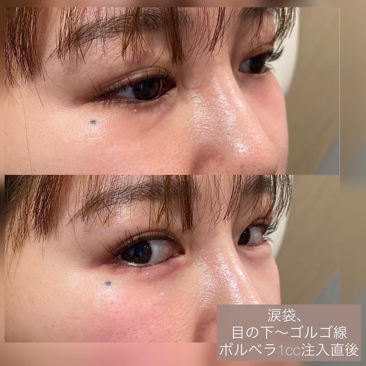症例写真