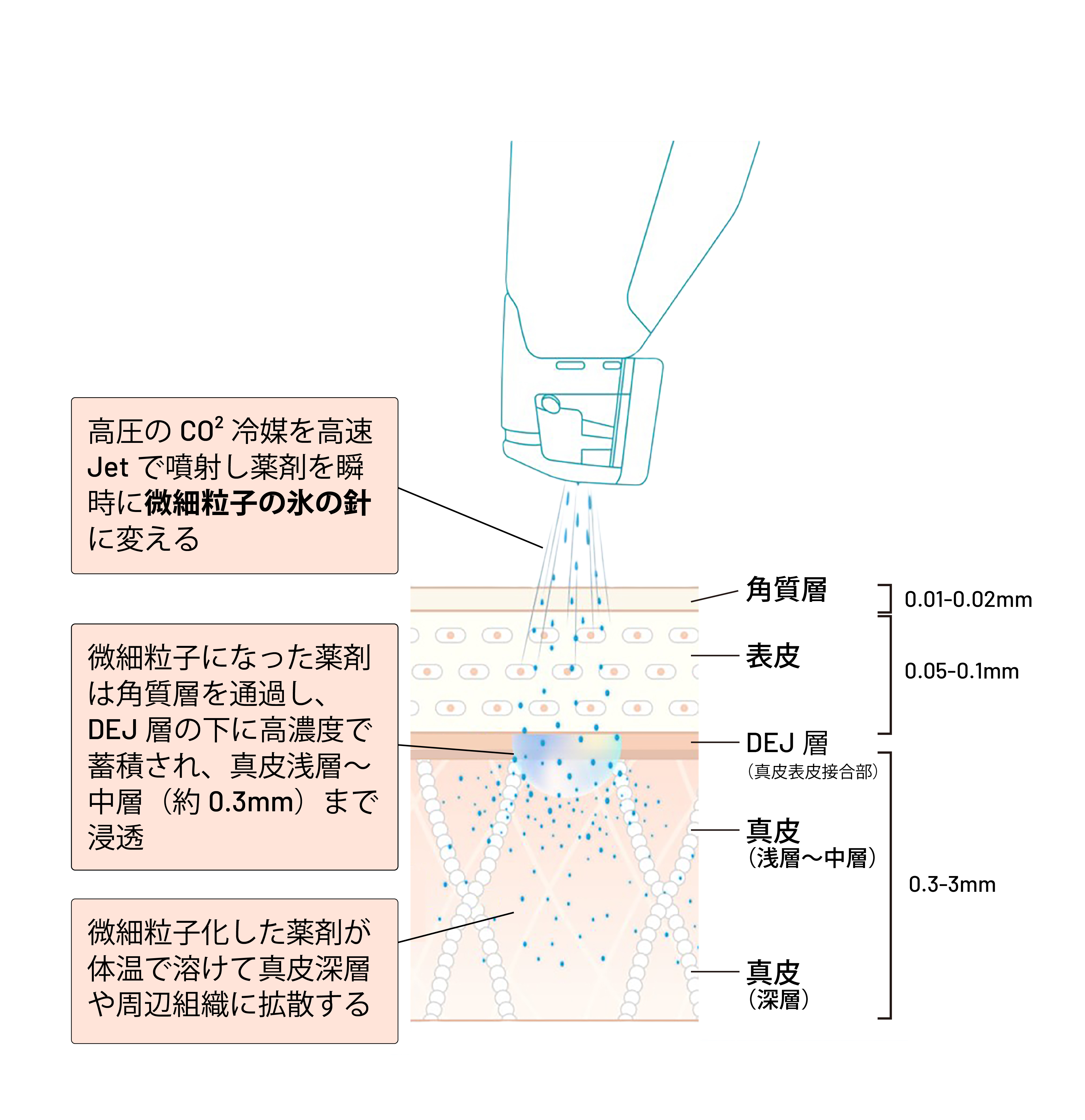 Ice Needling 仕組み図解
