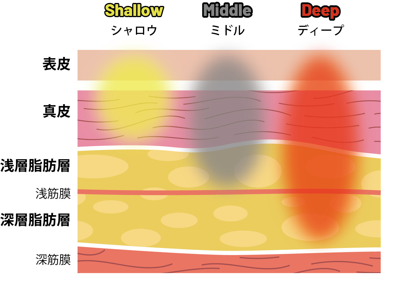 Shallow / Middle / Deep 深度設定イメージ