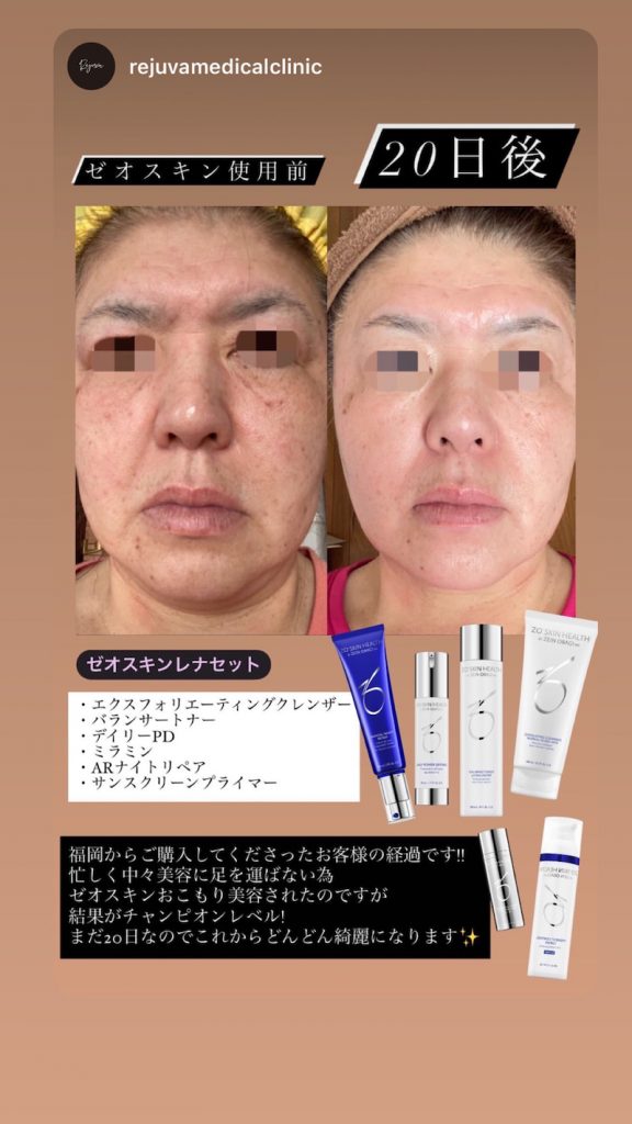 限定SALE定番人気 Obagi - ゼオスキン ＡＲナイトリペア 未開封の通販